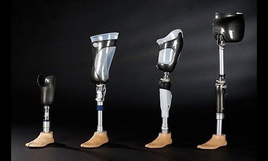 Protez bacak fiyatları ve protez bacak nedir?